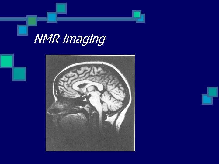 NMR imaging 