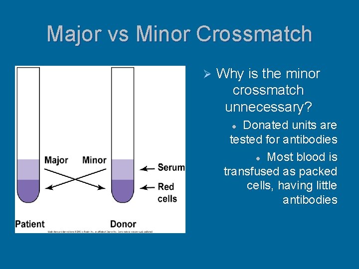 Major vs Minor Crossmatch Ø Why is the minor crossmatch unnecessary? Donated units are