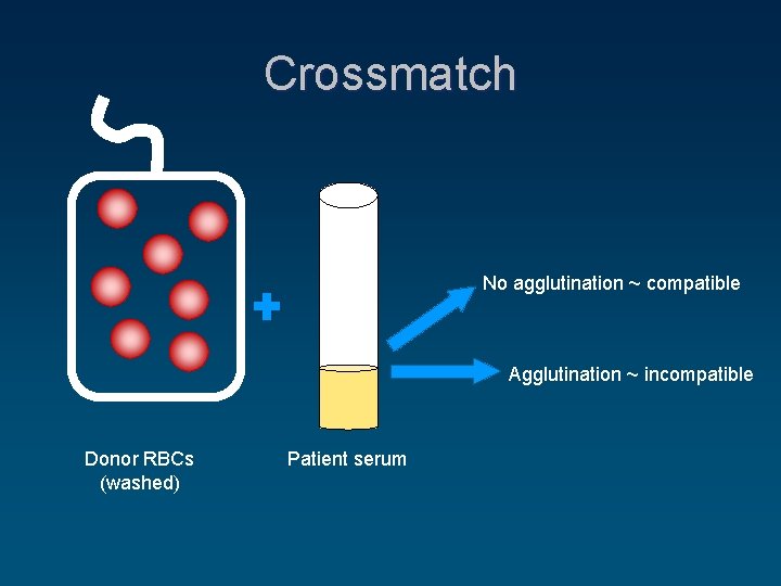 Crossmatch No agglutination ~ compatible Agglutination ~ incompatible Donor RBCs (washed) Patient serum 