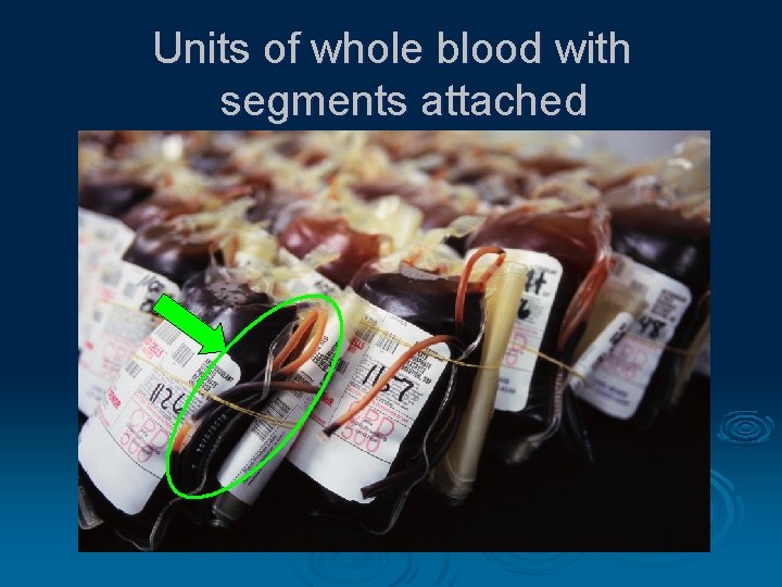 Units of whole blood with segments attached 