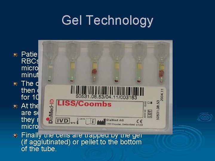 Gel Technology Patient serum, and 1% of suspended RBCs in LIM are dispensed into