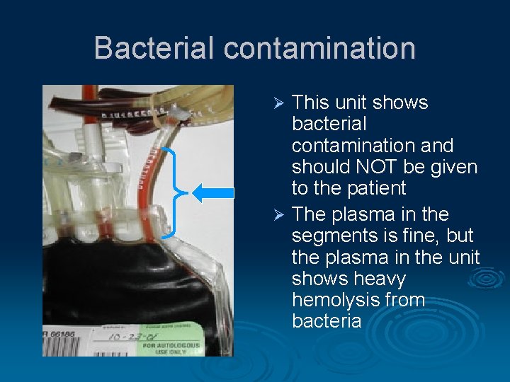 Bacterial contamination This unit shows bacterial contamination and should NOT be given to the