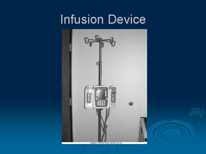 Infusion Device 