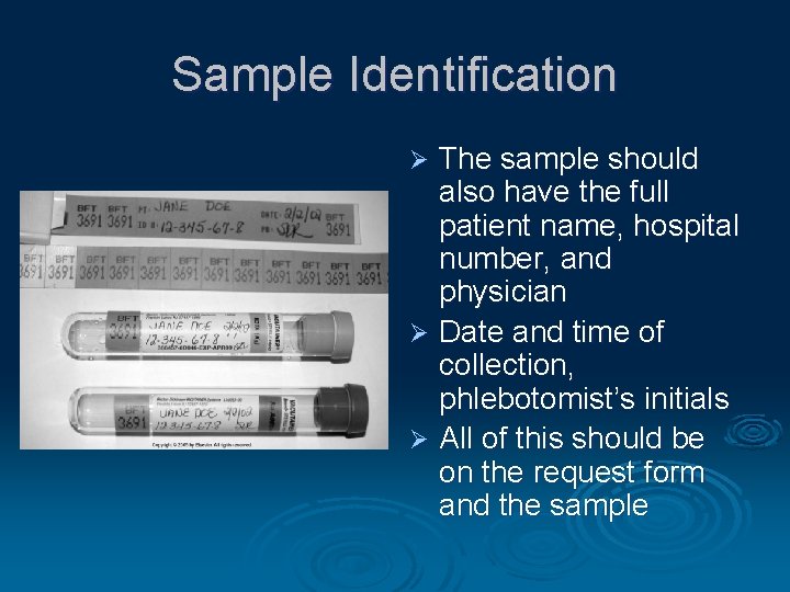 Sample Identification The sample should also have the full patient name, hospital number, and