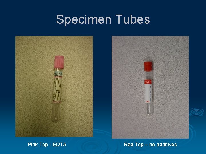 Specimen Tubes Pink Top - EDTA Red Top – no additives 