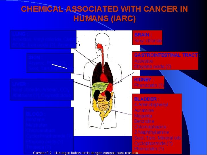 CHEMICAL ASSOCIATED WITH CANCER IN HUMANS (IARC) LUNG : Asbestos, Vinyl chloride, CMME, BCME,