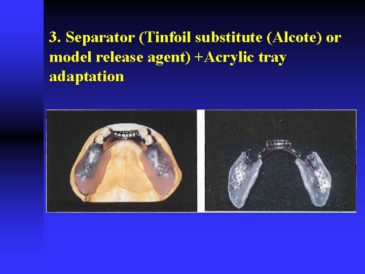 3. Separator (Tinfoil substitute (Alcote) or model release agent) +Acrylic tray adaptation 