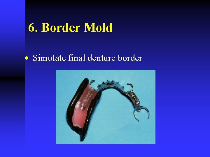 6. Border Mold · Simulate final denture border 