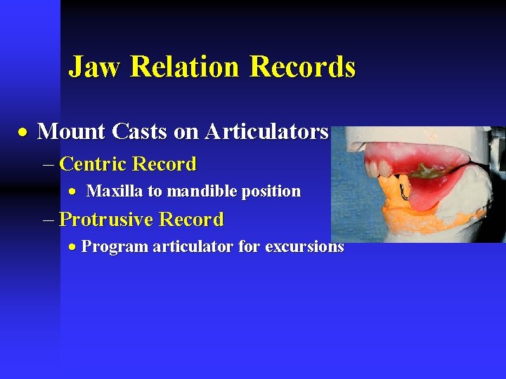 Jaw Relation Records · Mount Casts on Articulators - Centric Record · Maxilla to