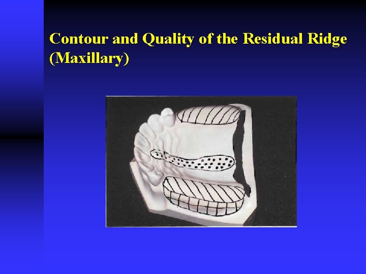 Contour and Quality of the Residual Ridge (Maxillary) 