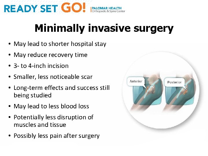 Minimally invasive surgery • May lead to shorter hospital stay • May reduce recovery