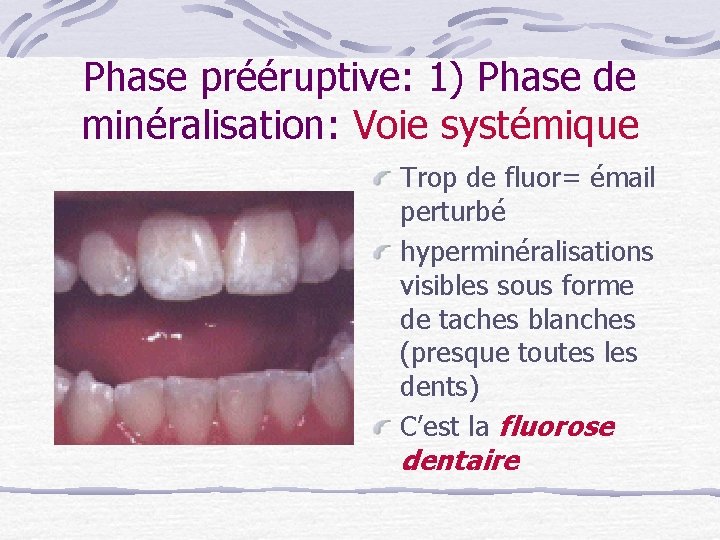 Phase prééruptive: 1) Phase de minéralisation: Voie systémique Trop de fluor= émail perturbé hyperminéralisations