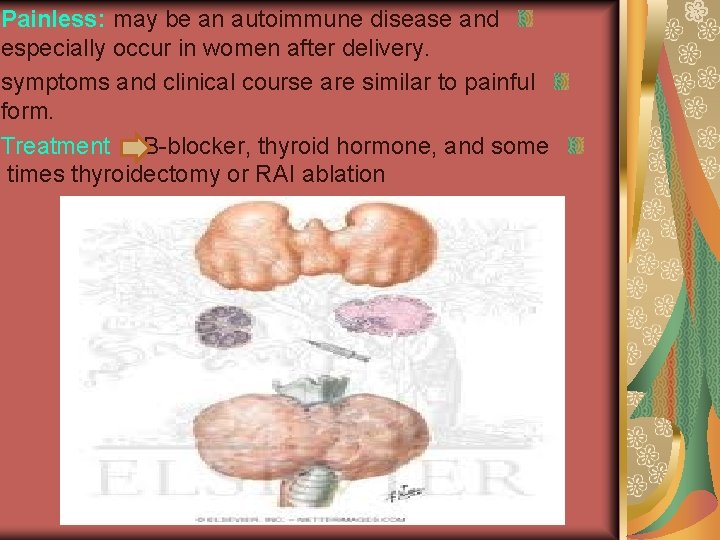 Painless: may be an autoimmune disease and especially occur in women after delivery. symptoms