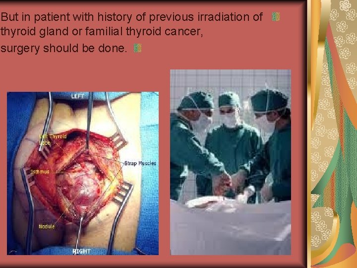 But in patient with history of previous irradiation of thyroid gland or familial thyroid