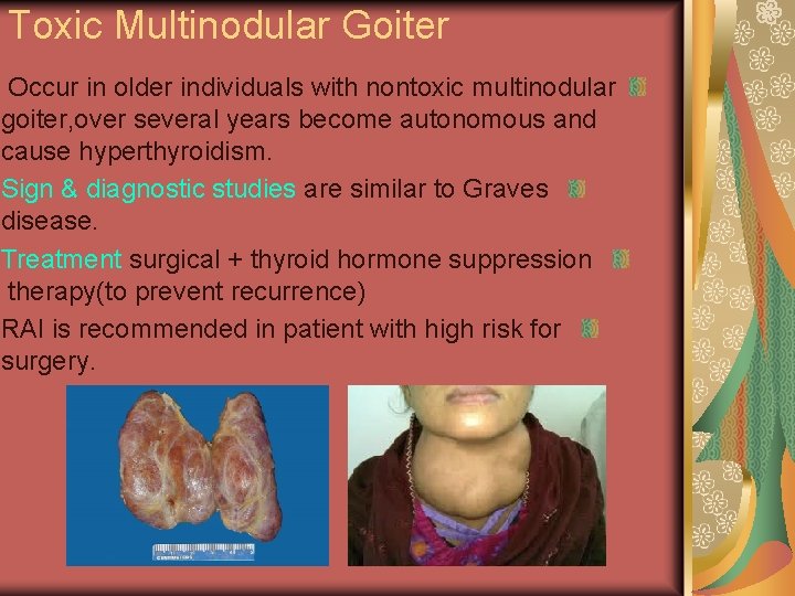 Toxic Multinodular Goiter Occur in older individuals with nontoxic multinodular goiter, over several years