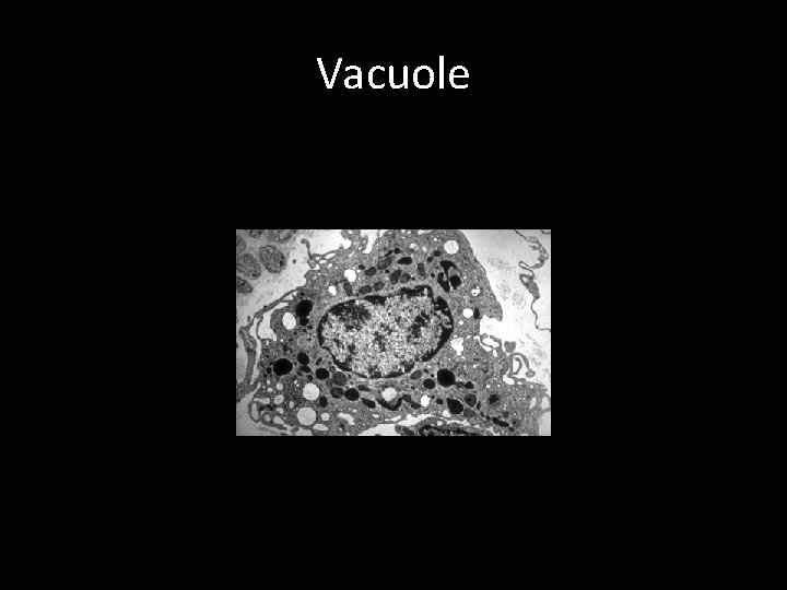 Vacuole 