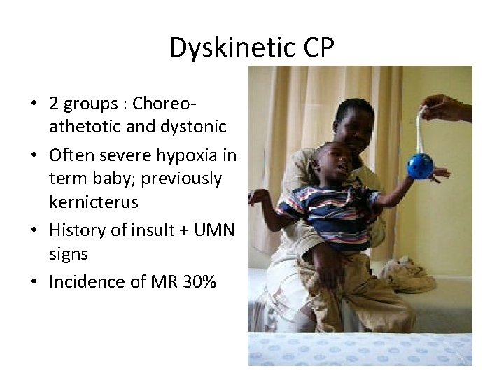Dyskinetic CP • 2 groups : Choreoathetotic and dystonic • Often severe hypoxia in