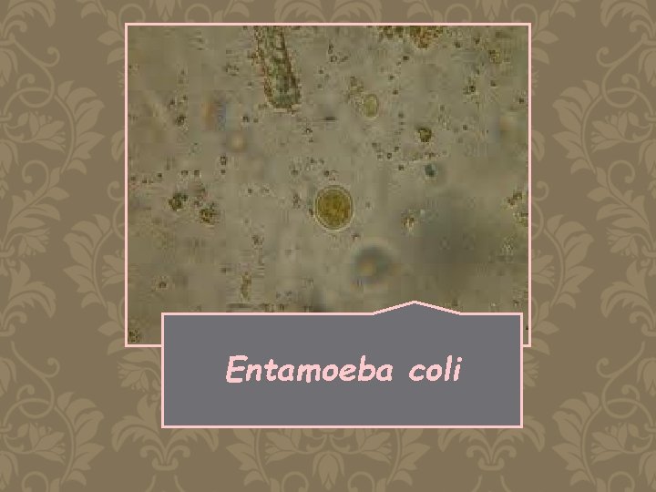 Entamoeba coli 