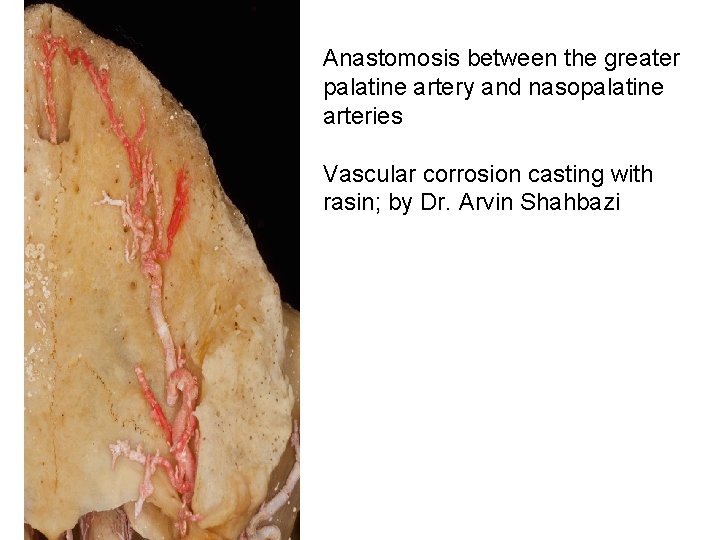 Anastomosis between the greater palatine artery and nasopalatine arteries Vascular corrosion casting with rasin;