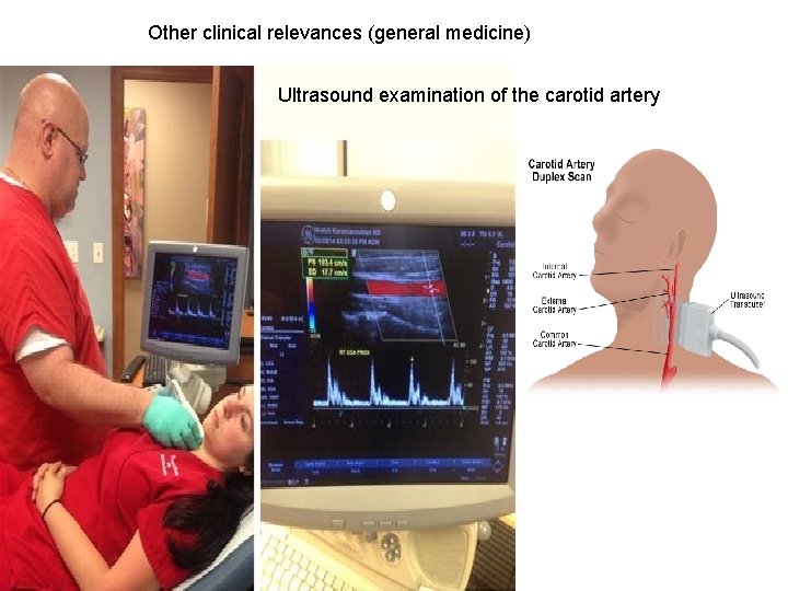 Other clinical relevances (general medicine) Ultrasound examination of the carotid artery 
