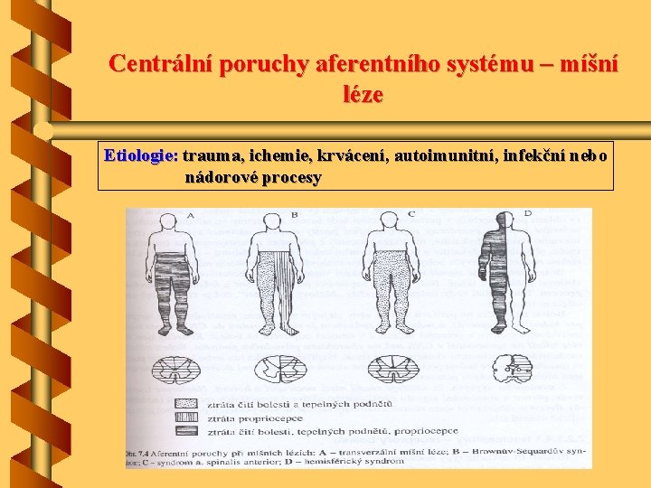 Centrální poruchy aferentního systému – míšní léze Etiologie: trauma, ichemie, krvácení, autoimunitní, infekční nebo