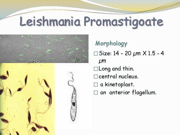 Leishmania Promastigoate Morphology �Size: 14 - 20 µm X 1. 5 - 4 µm