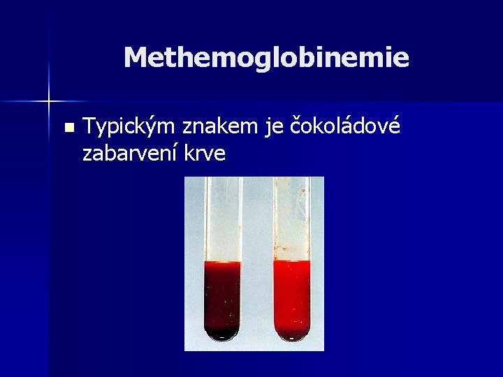Methemoglobinemie n Typickým znakem je čokoládové zabarvení krve 