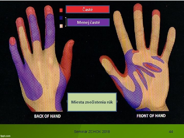 Časté Areas Most Frequently Missed Menej časté Miesta znečistenia rúk Seminár ZCHOK 2018 44