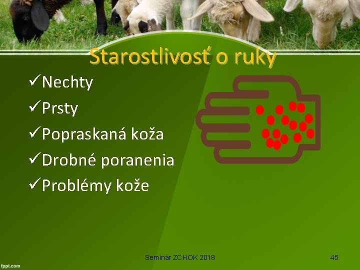 Starostlivosť o ruky üNechty üPrsty üPopraskaná koža üDrobné poranenia üProblémy kože Seminár ZCHOK 2018