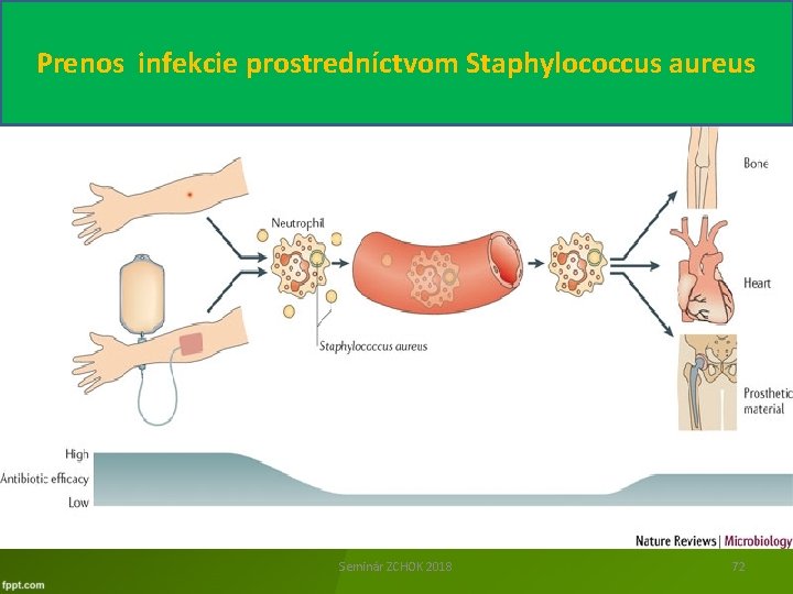Prenos infekcie prostredníctvom Staphylococcus aureus Seminár ZCHOK 2018 72 