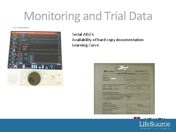 Monitoring and Trial Data Serial ABG’s Availability of hard copy documentation Learning Curve 