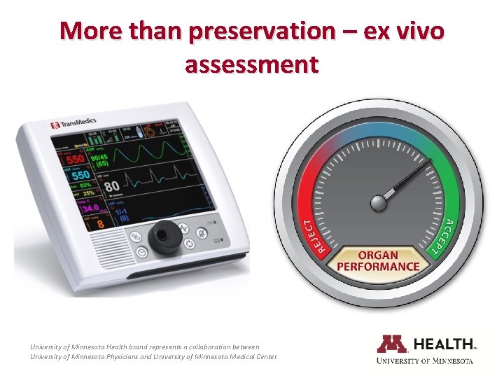 More than preservation – ex vivo assessment University of Minnesota Health brand represents a