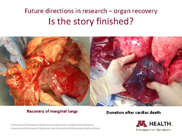 Future directions in research – organ recovery Is the story finished? Recovery of marginal
