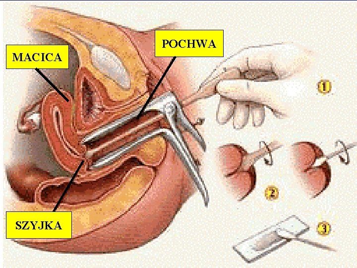 MACICA SZYJKA POCHWA 