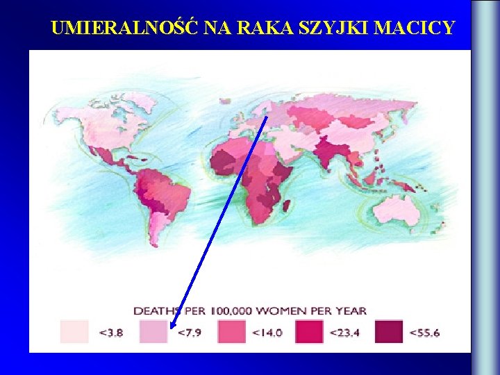 UMIERALNOŚĆ NA RAKA SZYJKI MACICY 