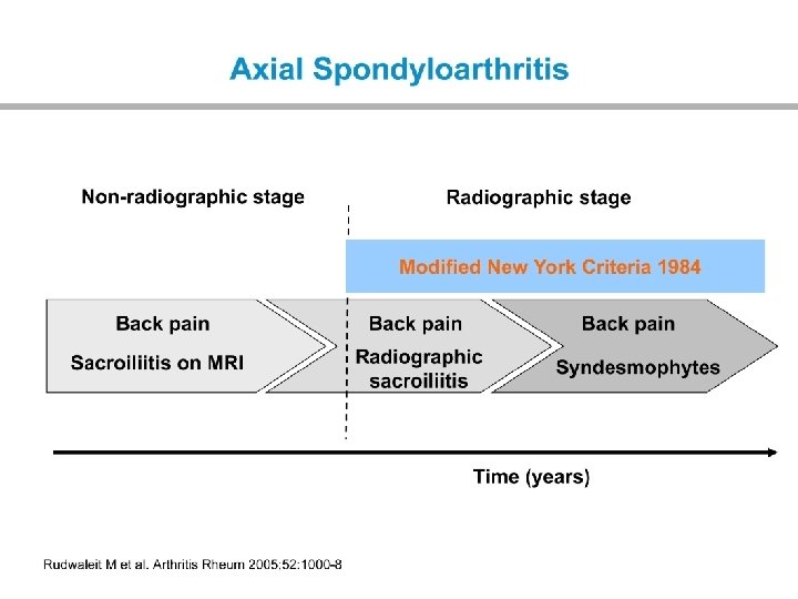 Inflammatory vs mechanical back pain Inflammatory Mechanical Age