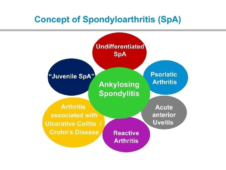 Inflammatory vs mechanical back pain Inflammatory Mechanical Age