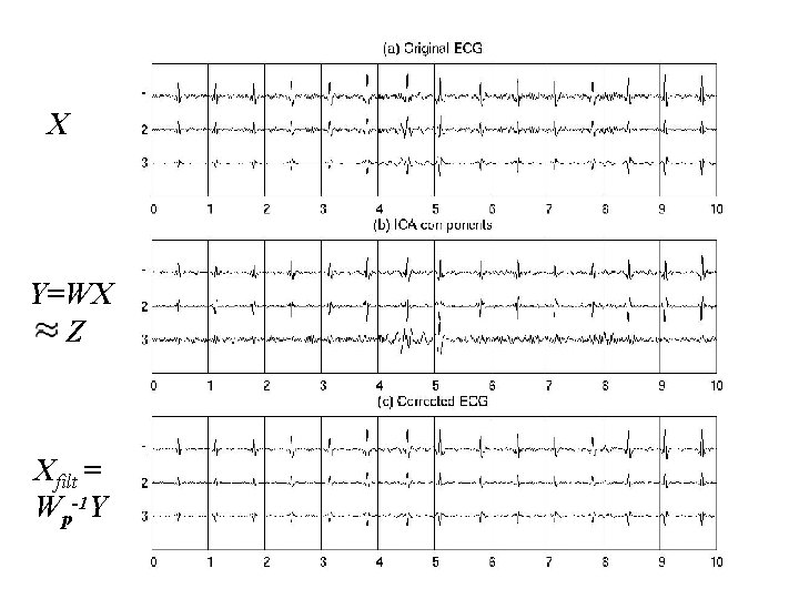 ICA results 4 X Y=WX Z Xfilt = Wp-1 Y 