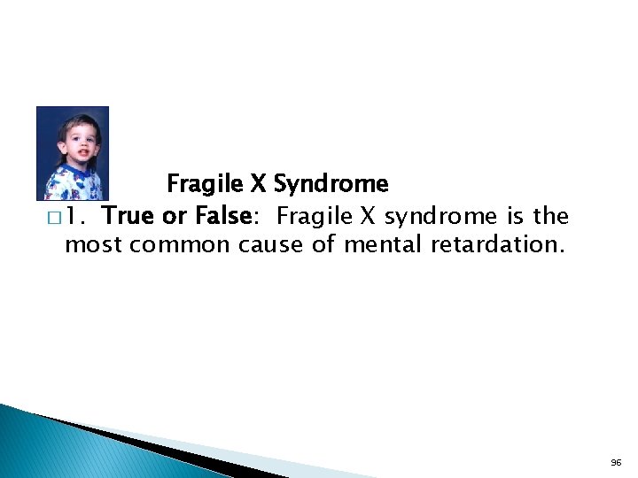 Fragile X Syndrome � 1. True or False: Fragile X syndrome is the most