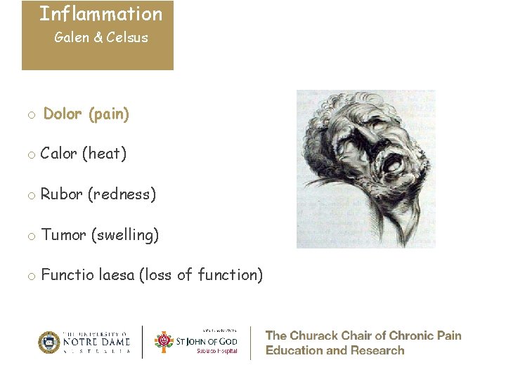 Inflammation Galen & Celsus o Dolor (pain) o Calor (heat) o Rubor (redness) o