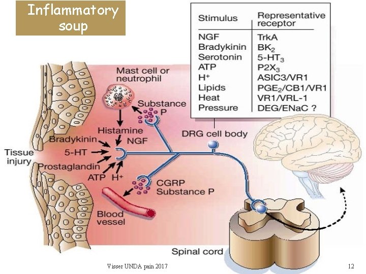 Inflammatory soup Visser UNDA pain 2017 12 