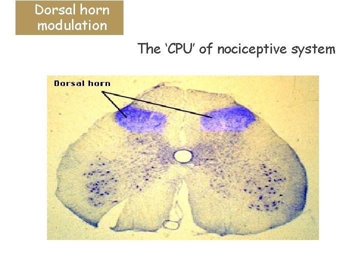 Dorsal horn modulation The ‘CPU’ of nociceptive system 