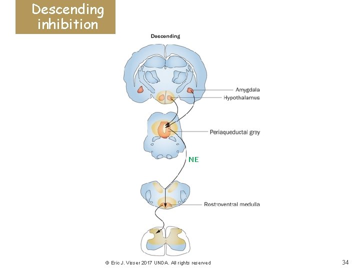 Descending inhibition NE © Eric J. Visser 2017 UNDA. All rights reserved 34 