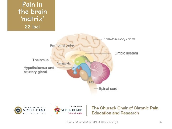 Pain in the brain ‘matrix’ 22 loci Somatosensory cortex Pre frontal cortex Amygdala RAS