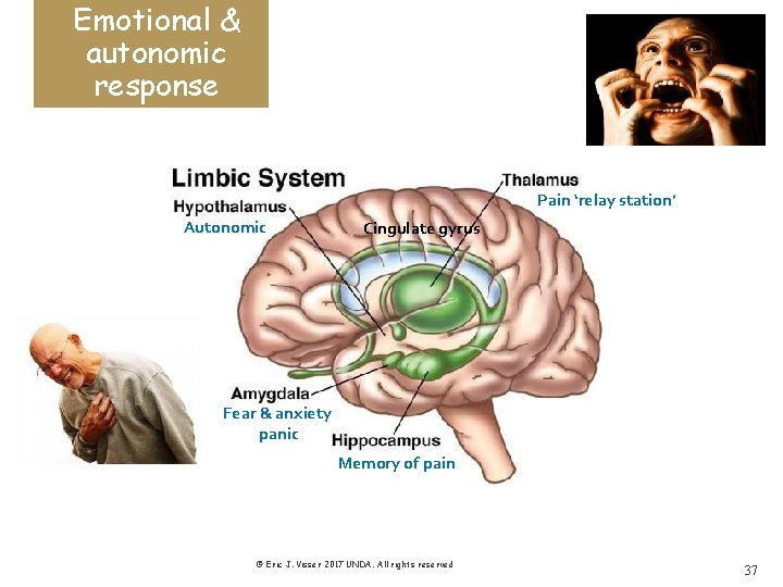 Emotional & autonomic response Pain ‘relay station’ Autonomic Cingulate gyrus Fear & anxiety panic