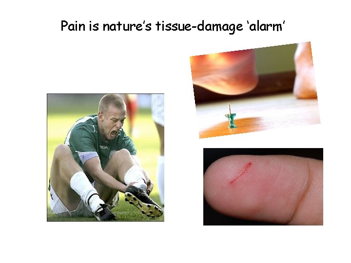 Pain is nature’s tissue-damage ‘alarm’ 