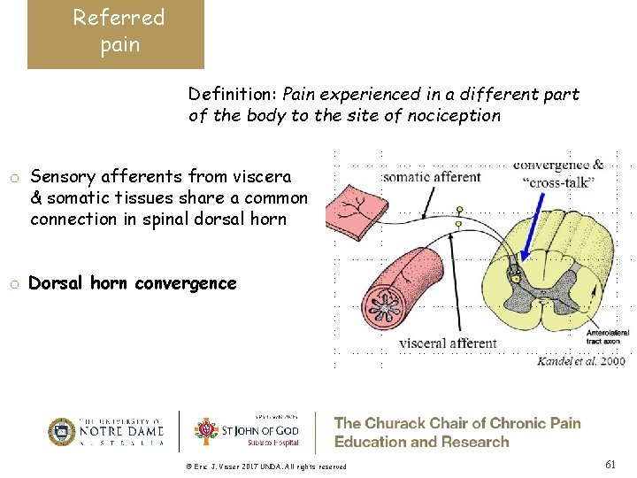 Referred pain Definition: Pain experienced in a different part of the body to the