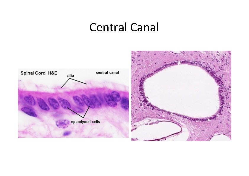 Central Canal 