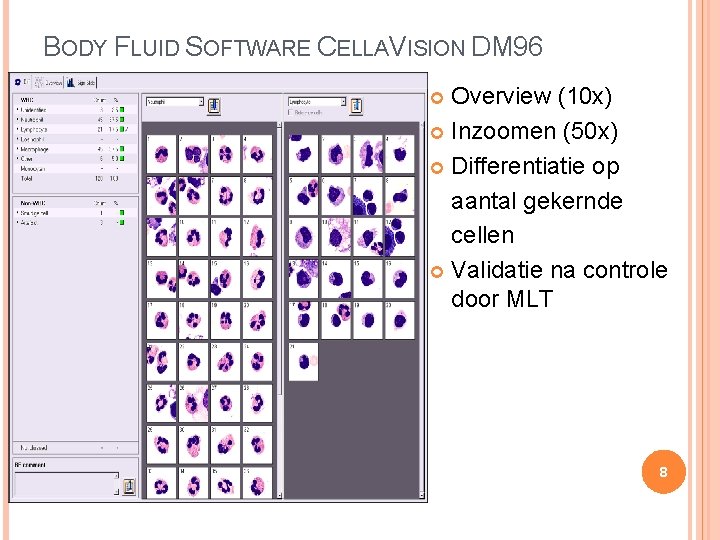 BODY FLUID SOFTWARE CELLAVISION DM 96 Overview (10 x) Inzoomen (50 x) Differentiatie op