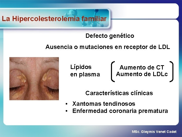 La Hipercolesterolemia familiar Defecto genético Ausencia o mutaciones en receptor de LDL Lípidos en